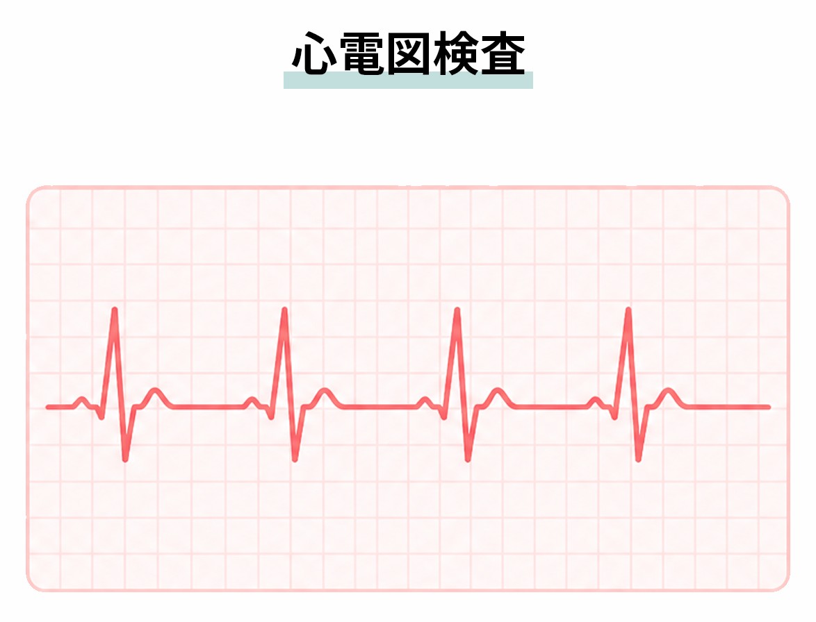 心電図検査