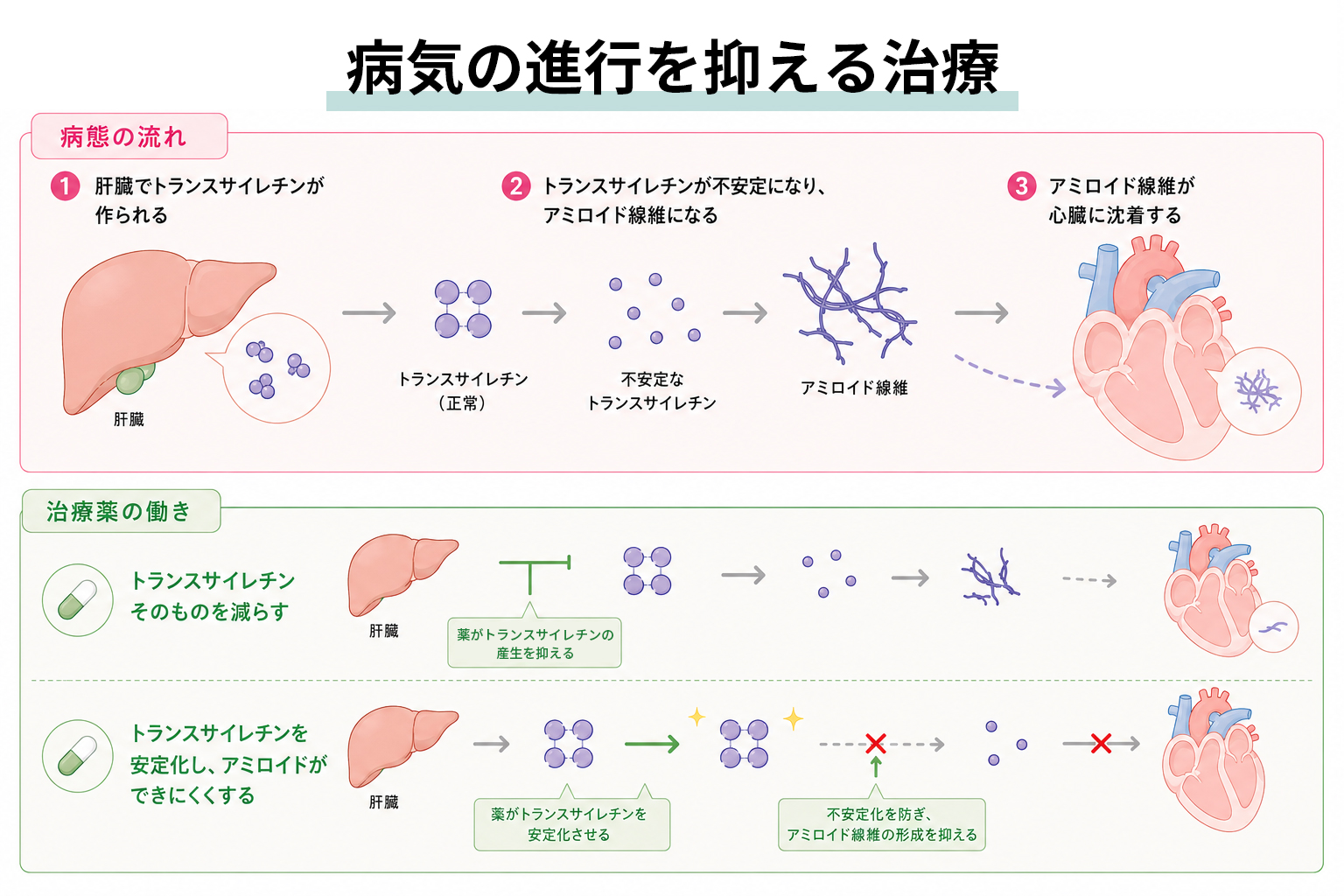 病気の進行を抑える治療